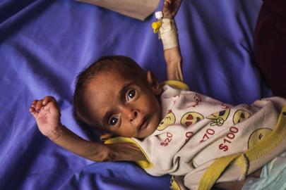 DSÖ: Gazze'de 18 bin 500'den fazla hastanın tahliye edilmesi gerekiyor