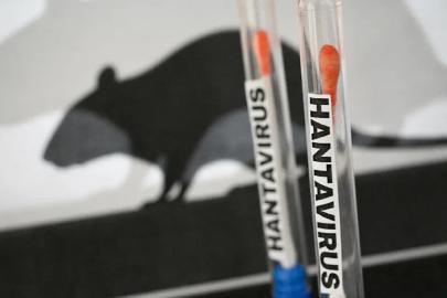 Hantavirüs bir salgına dönüşür mü?