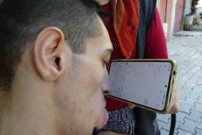 Engelleri burnuyla aştı: Telefonuyla hayata tutundu
