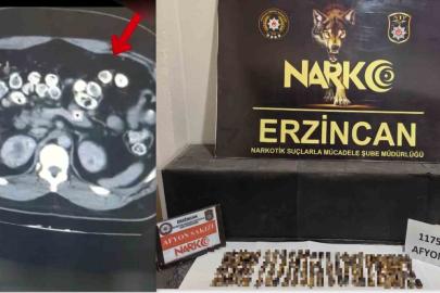 Erzincan’da uyuşturucuyu vücutlarında taşıyan 3 şüpheli yakalandı